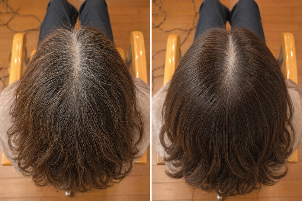 頭皮環境を整えるヘッドスパ