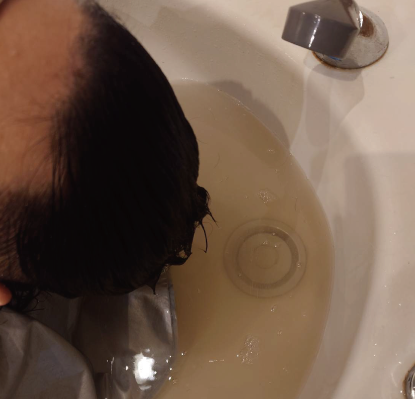 メンズトリートメント＆ヘッドスパ　男性の薄毛・抜け毛の改善