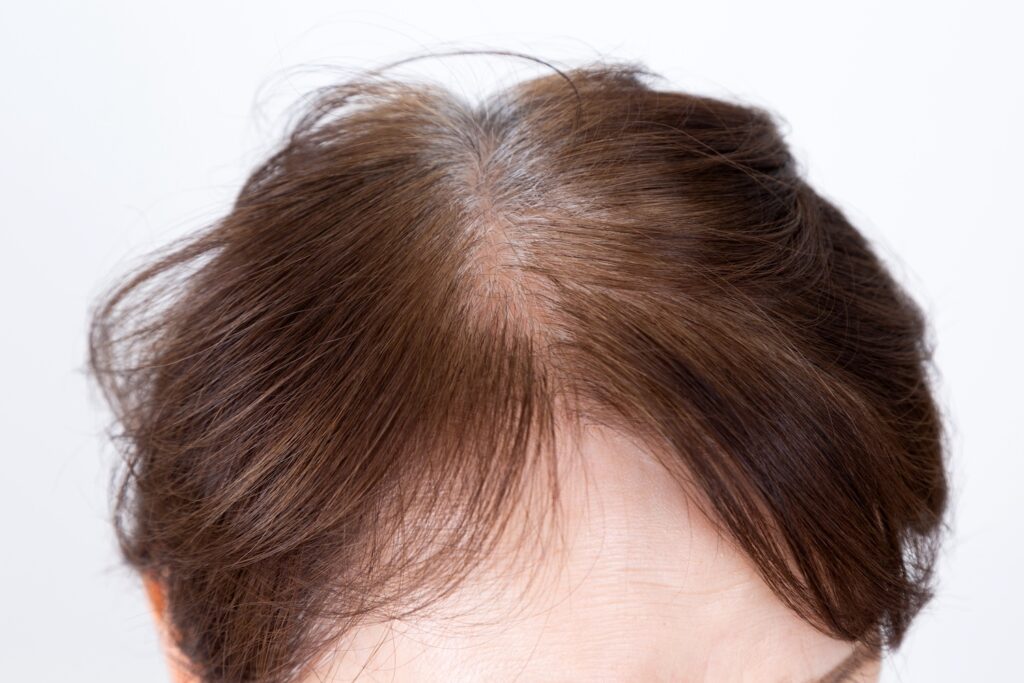 60代・70代で髪にボリュームが出ない｜分け目・つむじが目立つときの対処法